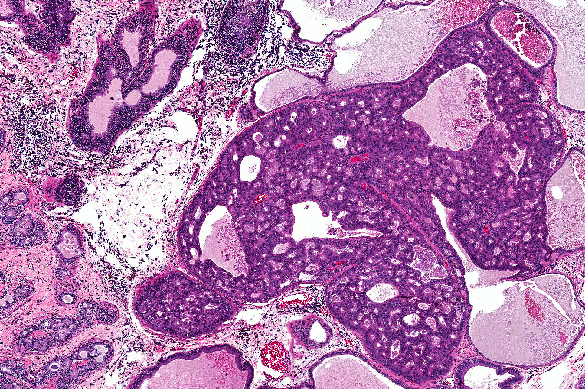 PhIP + E. coli in rat ventral prostate